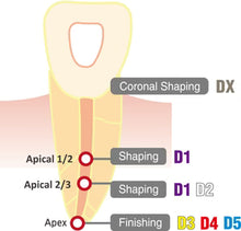 Load image into Gallery viewer, Dia-X NiTi Rotary Files  4/Pk-DiaDent