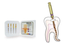 Load image into Gallery viewer, Dia-X NiTi Rotary Files  4/Pk-DiaDent