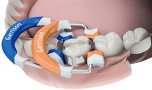Load image into Gallery viewer, Garrison Ring Composi Tight 3D Fusion Matrix Rings 2/Pack (FX400-FX500-FX600)