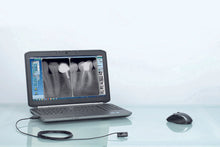 Load image into Gallery viewer, Owandy- OPTEO IntraOral Digital XRay Sensor Size #1&#2