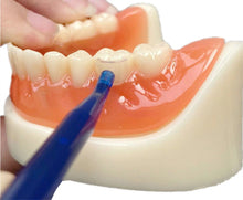 Load image into Gallery viewer, Transparent Cervical Matrices Fill Assorted Pack