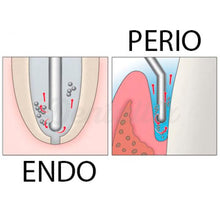 Load image into Gallery viewer, Endo Irrigation Syringes 100/Box (Compare to Max-i-Probe) Perio Irrigation Syringes